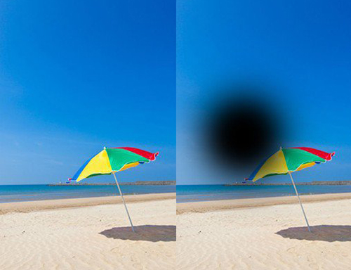 Degeneração Macular Relacionada à Idade (DMRI)